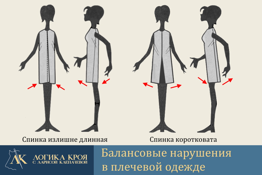 Нарушения переднезаднего баланса одежды